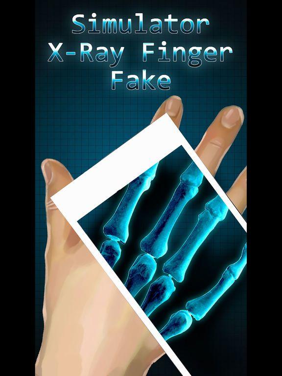 Portada de Simulator X-Ray Bone Fake